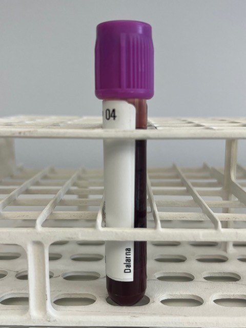 Etikett på rör.jpg