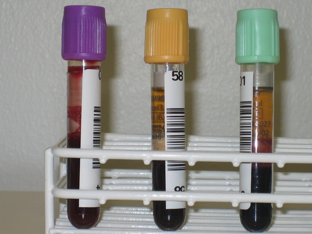 Tre stycken blodrör med korrekt placering av etiketter